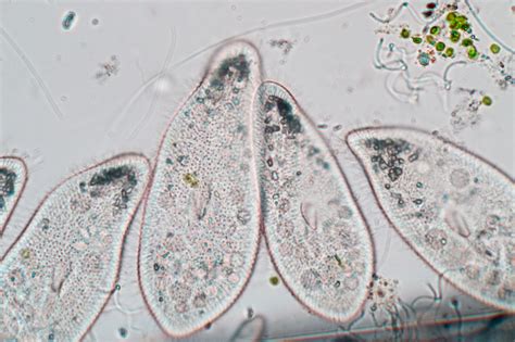  Oxytrichidae! Des Protozoaires Ciliés Magnifiques qui Dansent avec l’Eau