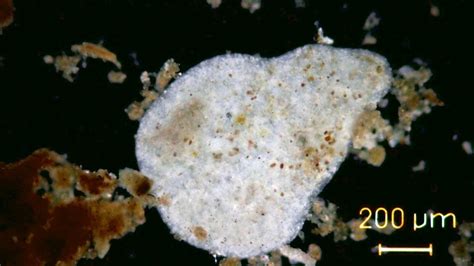  Pelomyxa! A Giant Amoeba With an Unexpected Taste for Algae